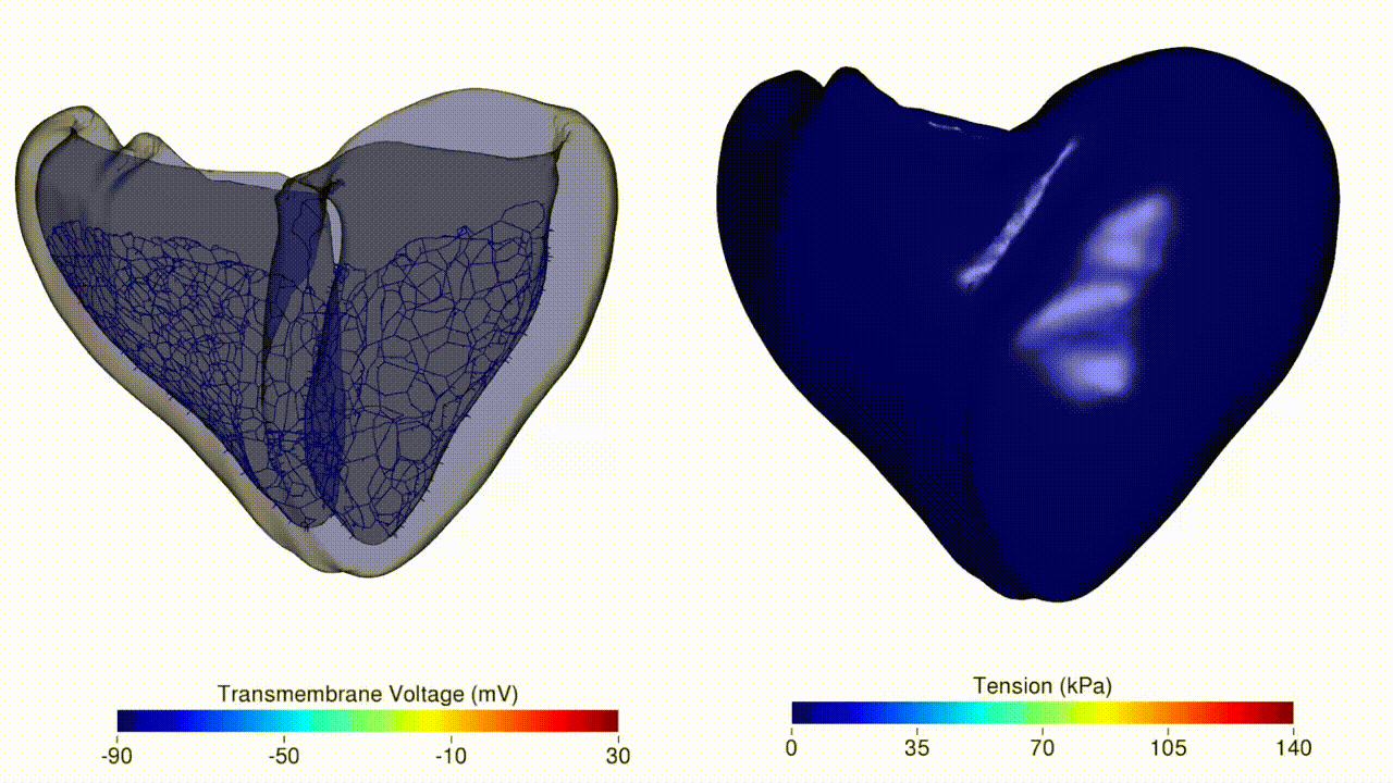 normal sinus rhythm simulation
