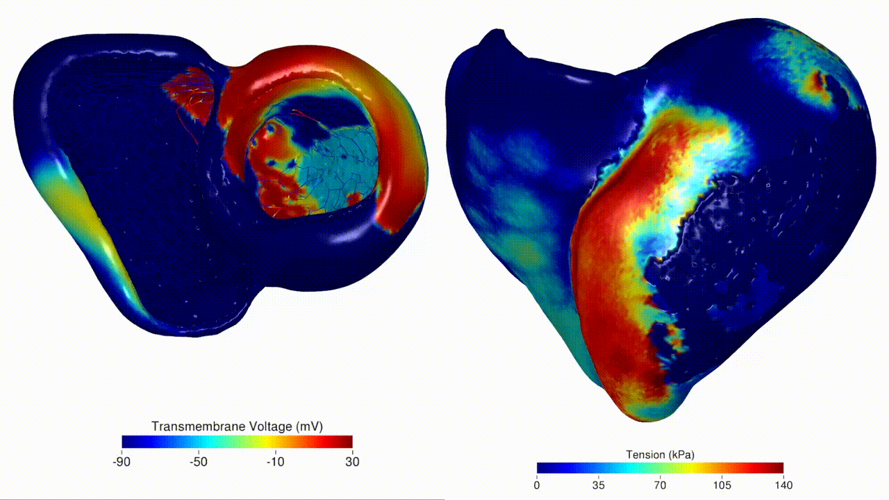 ventricular tachycardia simulation